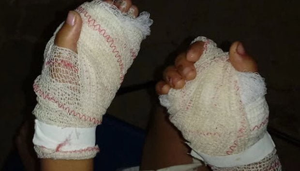 Irmão queima dois outros irmãos por roubarem 35 mil kwanzas da mãe