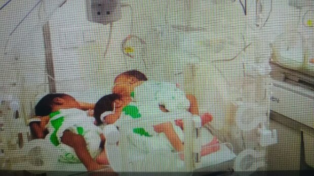 Mulher dá luz a quatro bebés na Huíla 