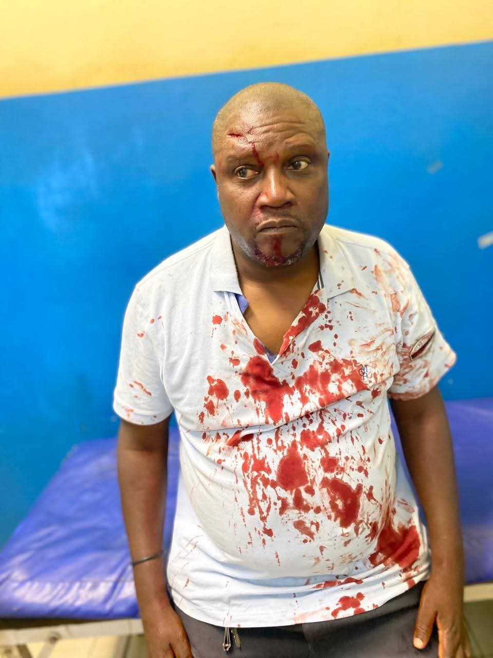 Aluno da 7ª Classe agride professor e lhe abre um “buraco” de cinco pontos